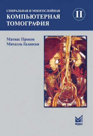 Спиральная и многослойная компьютерная томография. Том II
